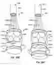 Fig. 42 - Everting heart valve