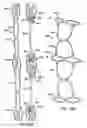 Fig. 44 - Everting heart valve
