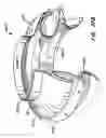 Fig. 47 - Everting heart valve