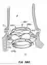 Fig. 49 - Everting heart valve