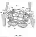 Fig. 50 - Everting heart valve