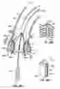 Fig. 53 - Everting heart valve