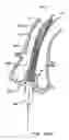 Fig. 55 - Everting heart valve