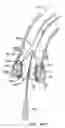 Fig. 57 - Everting heart valve