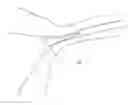 Fig. 01 - Devices and methods for occluding a fallopian tube