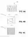 Fig. 06 - Devices and methods for occluding a fallopian tube