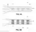 Fig. 07 - Devices and methods for occluding a fallopian tube