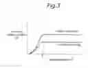 Fig. 04 - Electric power steering system