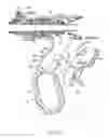 Fig. 13 - SURGICAL OPERATING APPARATUS