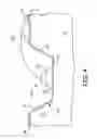 Fig. 05 - Optical sensing device for use in a medical device
