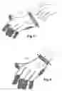 Fig. 03 - Chain mail article provided with an elastic tightening or tensioning body