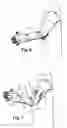 Fig. 05 - Chain mail article provided with an elastic tightening or tensioning body