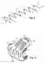 Fig. 06 - Chain mail article provided with an elastic tightening or tensioning body