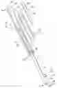 Fig. 01 - Archway measuring device