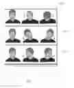 Fig. 02 - Dynamic cradle, especially for treating head and neck pain