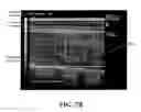 Fig. 14 - Systems, methods and devices for use in filter-based assessment of carcass grading