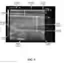 Fig. 16 - Systems, methods and devices for use in filter-based assessment of carcass grading