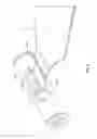 Fig. 03 - SPOOL INTERVERTEBRAL DISTRACTION DEVICE AND METHOD