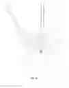 Fig. 11 - SPOOL INTERVERTEBRAL DISTRACTION DEVICE AND METHOD