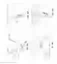 Fig. 12 - SPOOL INTERVERTEBRAL DISTRACTION DEVICE AND METHOD