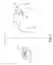 Fig. 02 - Lead-implant coupling device