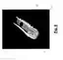 Fig. 08 - Coated Implants