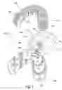 Fig. 04 - TOOTH BRUSHING SYSTEM