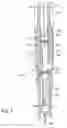 Fig. 02 - Method and apparatus for continuously injecting fluid in a wellbore while maintaining safety valve operation