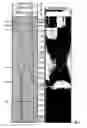 Fig. 06 - Analyzing resistivity images for determining downhole events and removing image artifacts