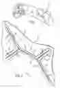 Fig. 02 - AIR BAG COVER