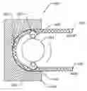 Fig. 01 - PERISTALTIC PUMP
