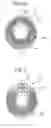 Fig. 08 - Plasma reactor