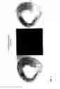 Fig. 03 - Use of Fluorine-Containing Compounds for Diagnostic Purposes Using Imaging Methods