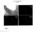 Fig. 04 - Use of Fluorine-Containing Compounds for Diagnostic Purposes Using Imaging Methods