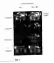 Fig. 05 - Use of Fluorine-Containing Compounds for Diagnostic Purposes Using Imaging Methods