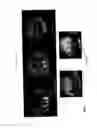 Fig. 06 - Use of Fluorine-Containing Compounds for Diagnostic Purposes Using Imaging Methods