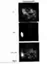Fig. 07 - Use of Fluorine-Containing Compounds for Diagnostic Purposes Using Imaging Methods