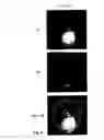 Fig. 09 - Use of Fluorine-Containing Compounds for Diagnostic Purposes Using Imaging Methods
