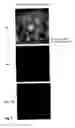 Fig. 10 - Use of Fluorine-Containing Compounds for Diagnostic Purposes Using Imaging Methods