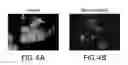 Fig. 06 - Delivery Of Double-Stranded RNA Into The Central Nervous System