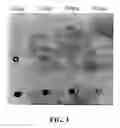 Fig. 02 - Methods and compounds for the treatment of mucus hypersecretion