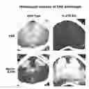 Fig. 01 - METHODS FOR TREATING AUTOIMMUNE DISORDERS