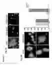 Fig. 06 - Isolation of the Mitotic Spindle Matrix and its Methods of Use