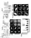 Fig. 09 - Isolation of the Mitotic Spindle Matrix and its Methods of Use