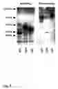Fig. 04 - COMPOSITIONS AND METHODS FOR INHIBITING TOXIN A FROM CLOSTRIDIUM DIFFICILE