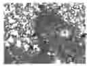 Fig. 01 - Genetic adjuvants for immunotherapy