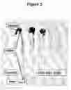 Fig. 03 - CONTROL OF INTESTINAL INFLAMMATORY SYNDROMES WITH A PREPARATION OF KILLED OR NON INFECTIOUS BACTERIA