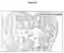 Fig. 10 - CONTROL OF INTESTINAL INFLAMMATORY SYNDROMES WITH A PREPARATION OF KILLED OR NON INFECTIOUS BACTERIA