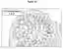 Fig. 12 - CONTROL OF INTESTINAL INFLAMMATORY SYNDROMES WITH A PREPARATION OF KILLED OR NON INFECTIOUS BACTERIA