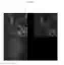 Fig. 15 - Collagen-based matrices with stem cells